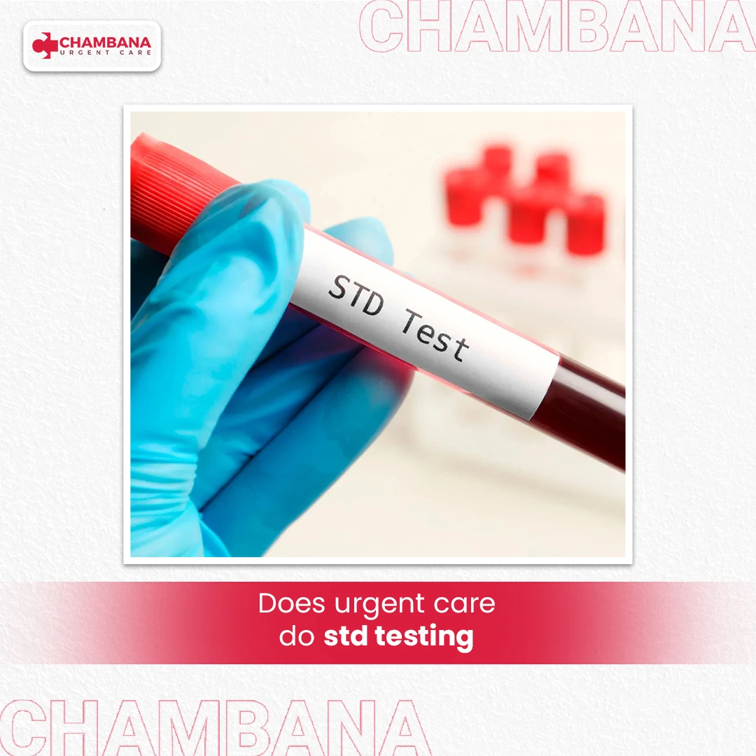 Does Urgent Care Do STD Testing? What You Need to Know