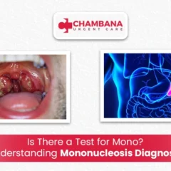 Is There a Test for Mono? Understanding Mononucleosis Diagnosis