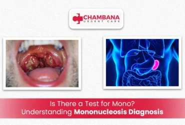 is there a test for mono