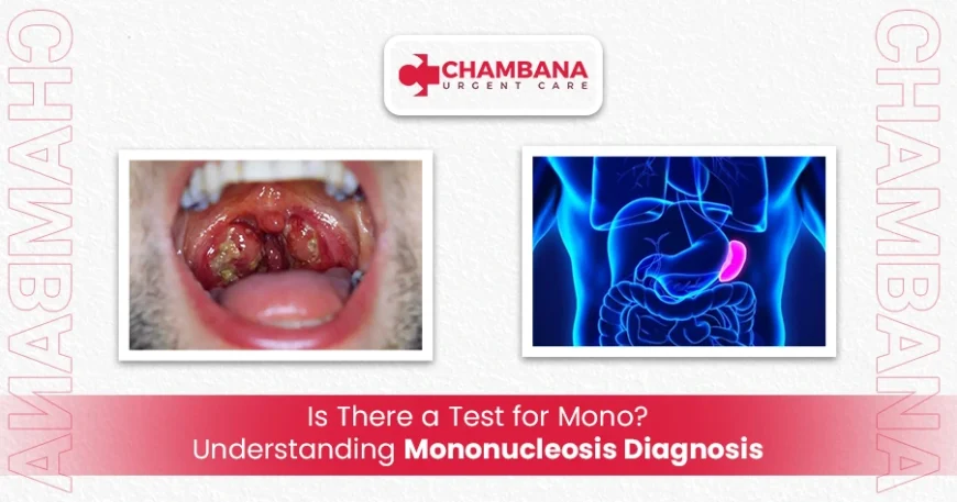 Is There a Test for Mono? Understanding Mononucleosis Diagnosis 1 is there a test for mono