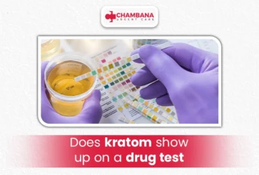 does kratom show up on a drug test