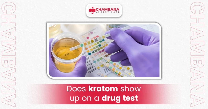 Does Kratom Show Up on a Drug Test? 1 does kratom show up on a drug test
