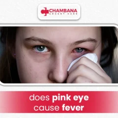Does Pink Eye Cause Fever?