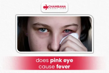 does pink eye cause fever?