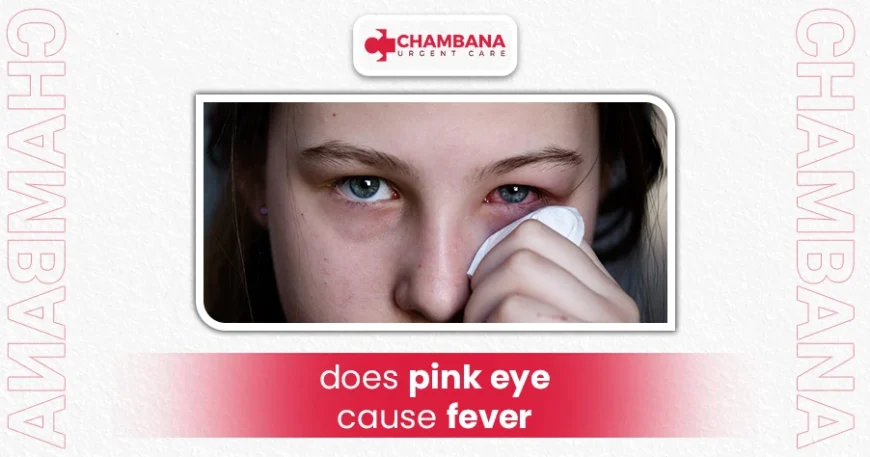 Does Pink Eye Cause Fever? 1 does pink eye cause fever?