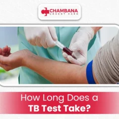 How Long Does a TB Test Take?