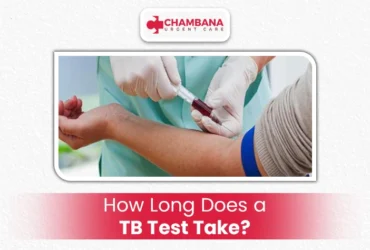 How Long Does a TB Test Take