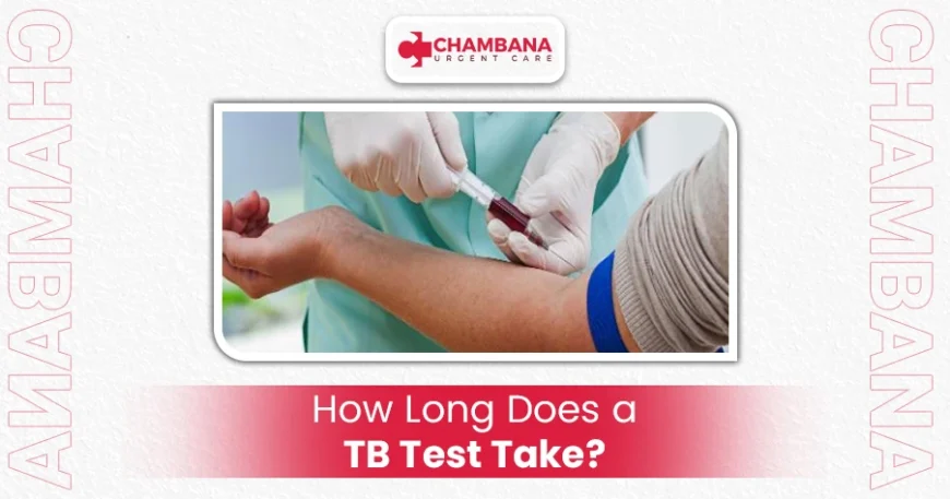 How Long Does a TB Test Take? 1 How Long Does a TB Test Take